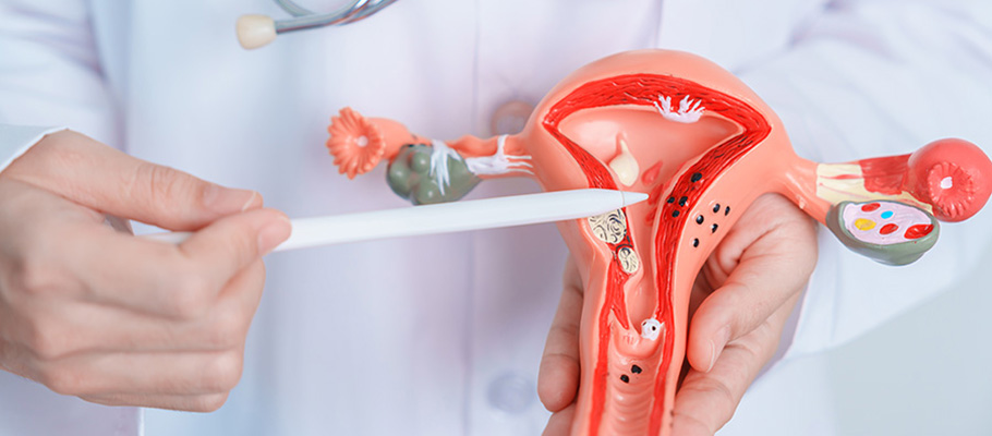 Pólipos en el colon y hemorroides