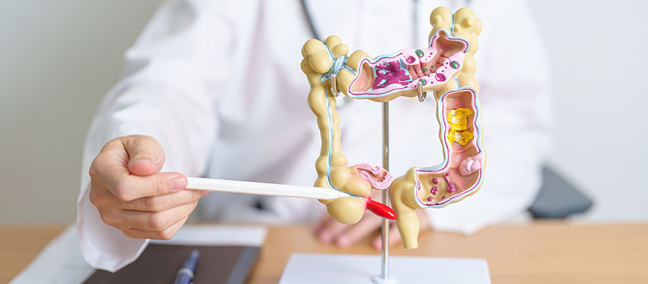 Médico con modelo de anatomía de colon humano