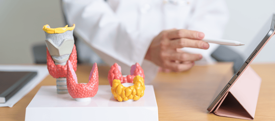 ¿Qué relación tiene el hipotiroidismo con las hemorroides?